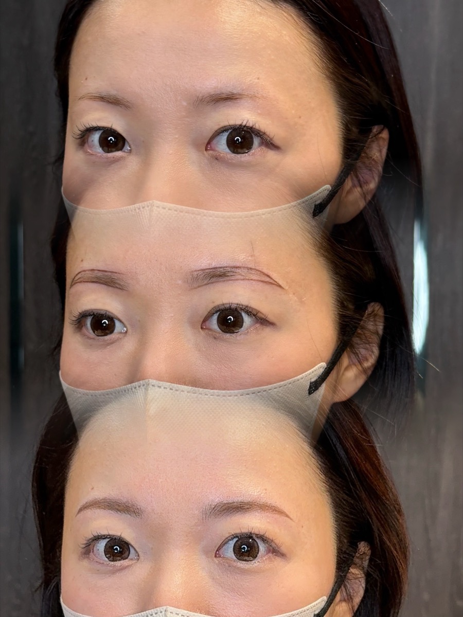 眉アートメイクの症例 Before / After