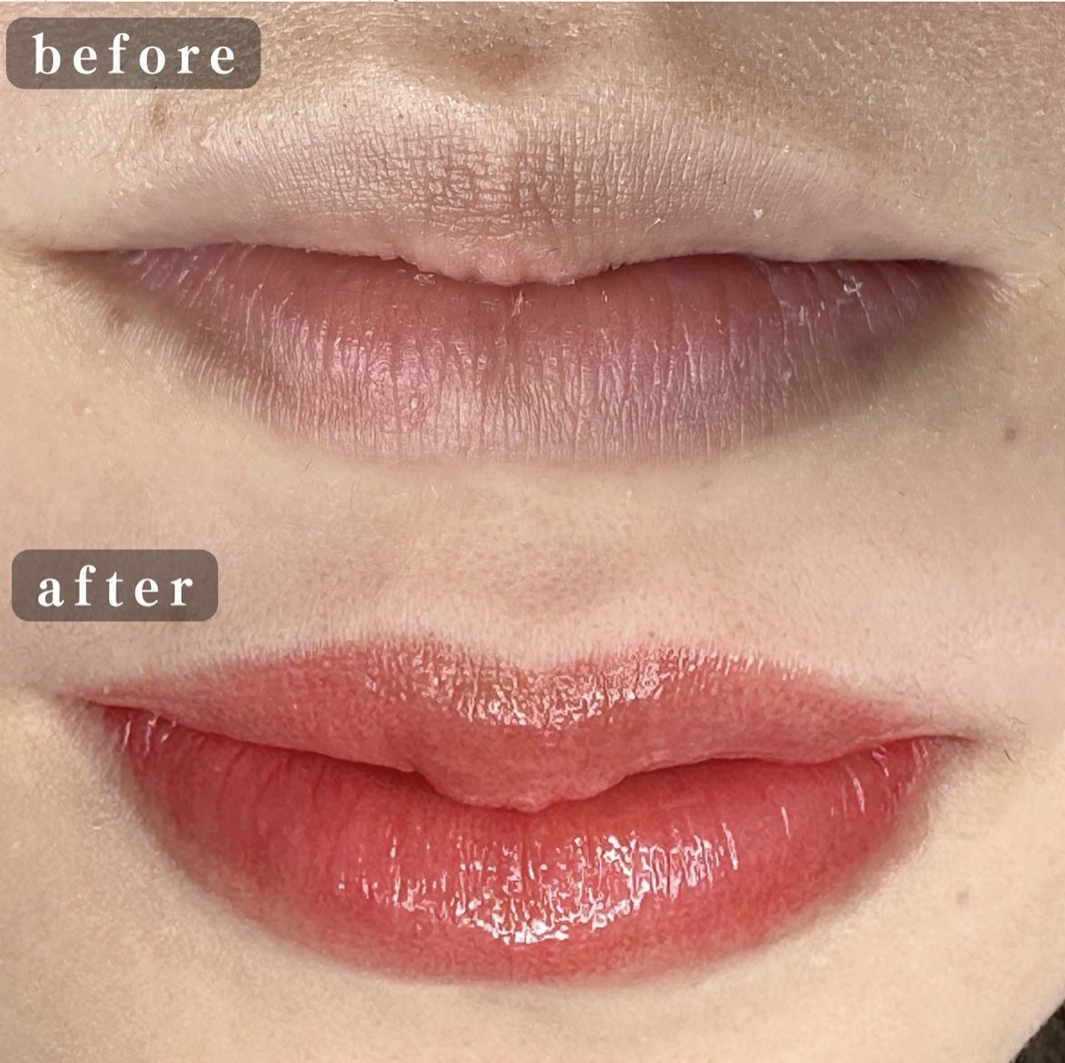 リップアートメイクの症例 Before / After